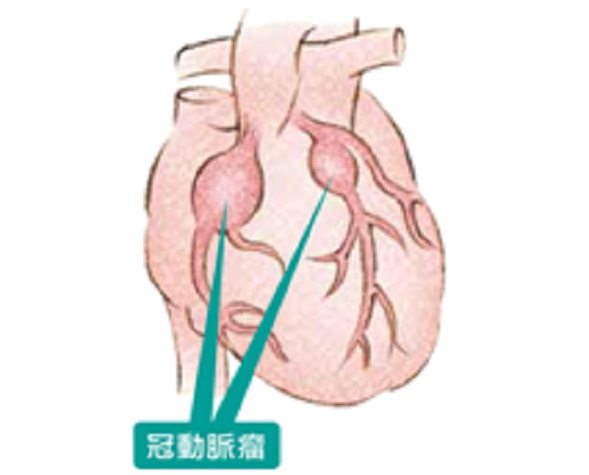 乳幼児を持つパパとママへ | 長引くその高熱は「川崎病」かも？ | 長女が発病した時の様子